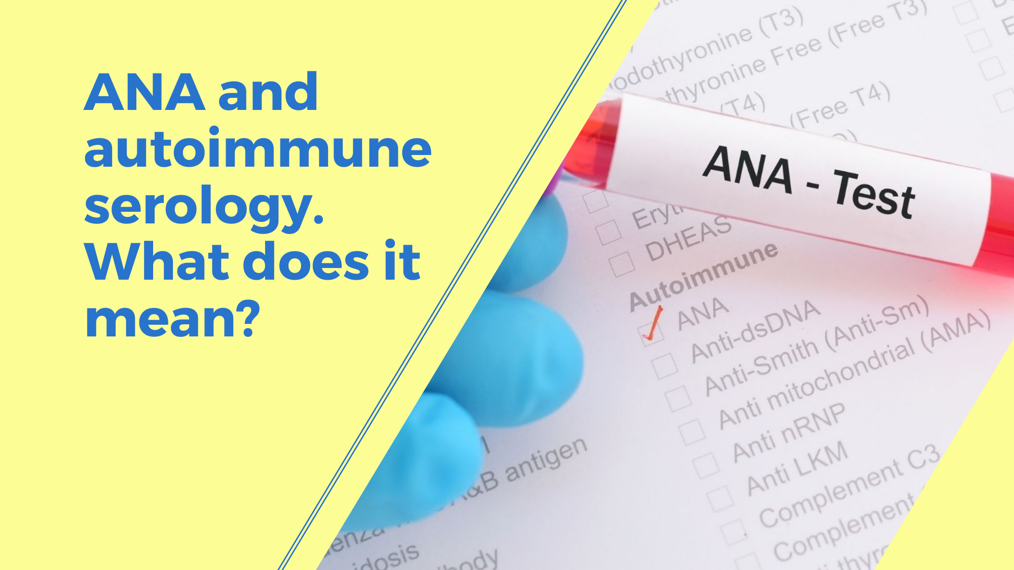 ANA and autoimmune serology. What does it mean?